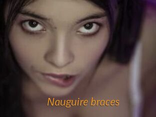 Nauguire_braces